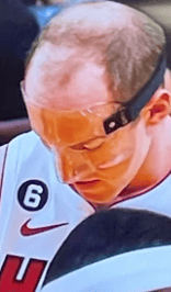 Cody Zeller's hair line